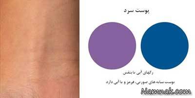 انواع رنگ پوست