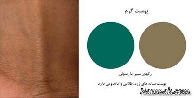 انواع رنگ پوست