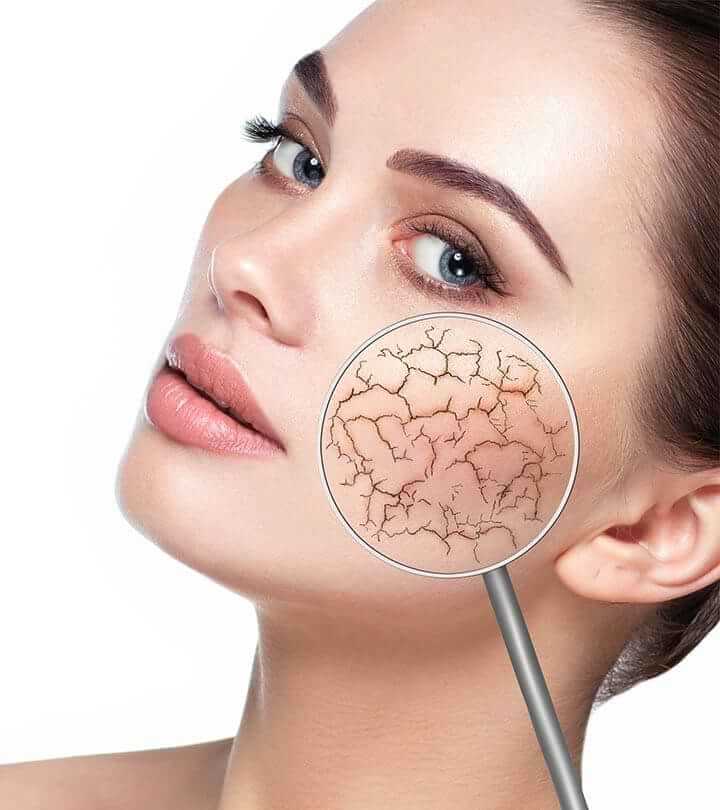 سرم پوست برای کاهش خشکی