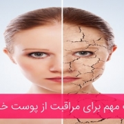 مراقبت از پوست خشک