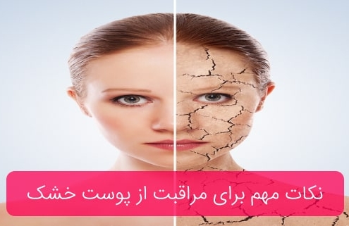 مراقبت از پوست خشک