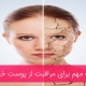 مراقبت از پوست خشک