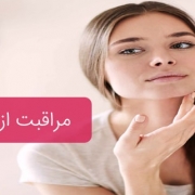 مراقبت از پوست چرب