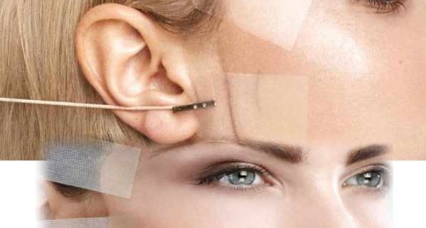 چسب لیفت صورت چیست؟