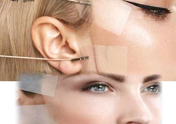 چسب لیفت صورت چیست؟